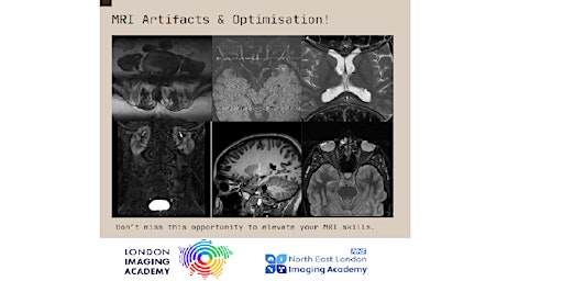 Imagem principal do evento MRI Artefacts and Optimisation