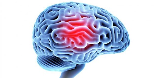 Traumatic Brain Injury (TBI) 101 primary image