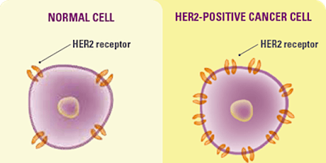 HER-2 Positive Early Breast Cancer: Adjuvant treatment options primary image