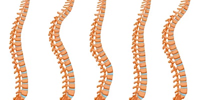 Navigating the spine: A comprehensive guide to back surgery for GP’s  primärbild