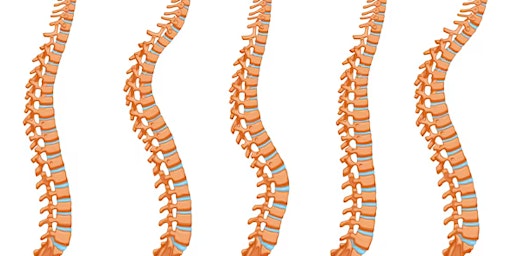 Imagem principal do evento Navigating the spine: A comprehensive guide to back surgery for GP’s