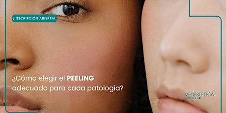 Hauptbild für Curso de Protocolos actuales de Peelings y renovación de la piel