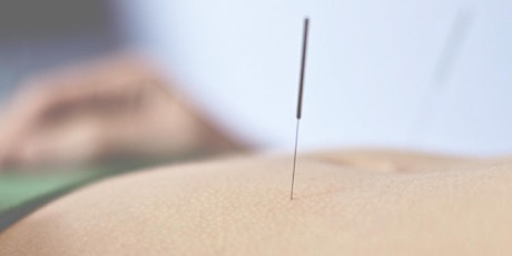 Croydon Community Acupuncture - Ongoing