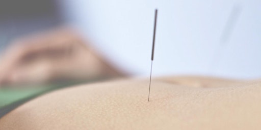 Image principale de Croydon Community Acupuncture - Ongoing