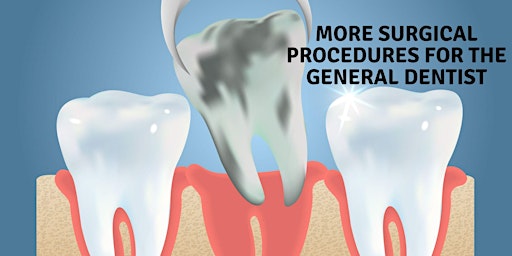 More Surgical Procedures for the General Dentist  primärbild