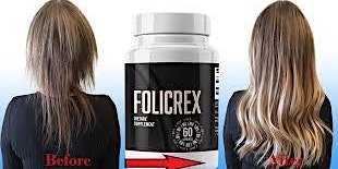 Imagen principal de Folicrex Hair Growth Capsule Results
