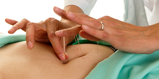 Acupuncture for Fertility primary image