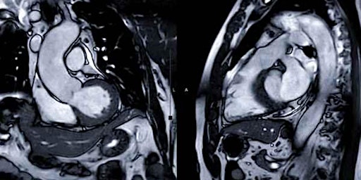 MRI Course: Head & Neck, Neuro, MSK, Abdominal primary image