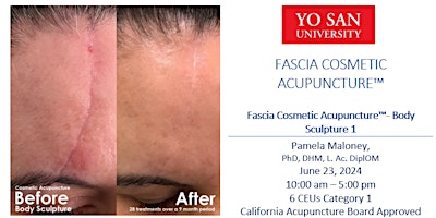 Fascia Cosmetic Acupuncture - Body Sculpture primary image