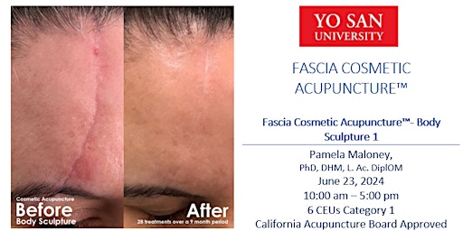 Imagem principal do evento Fascia Cosmetic Acupuncture - Body Sculpture