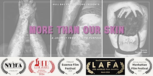 "More Than Our Skin" Minnesota Film Premiere primary image