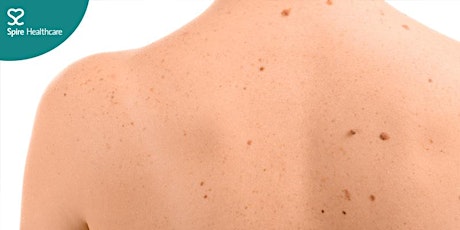Free patient event | Skin cancer: more than skin deep