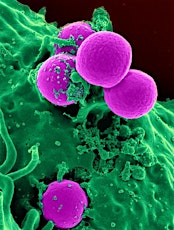 The Threat of Antimicrobial Resistance and What We Need to Do About It primary image