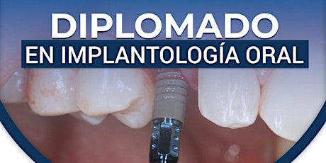 Imagen principal de Diplomado en Implante