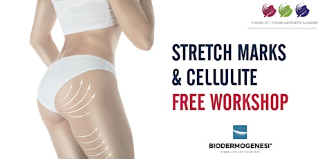 FREE Stretch Mark & Cellulite Workshop with Biodermogenesi - FEBRUARY primary image