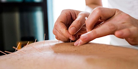 Information Webinar : Integrative Acupuncture Certificate in Canada primary image