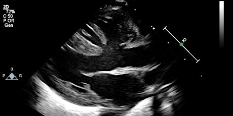 Echocardiography in Congenital Heart Disease primary image