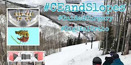 Imagen principal de #CEandSlopes - Guided Surgery and Clear Aligners - Park City, UT - March 13&14