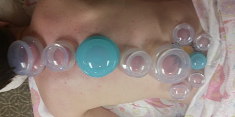 LMT CE: Intro to Cupping primary image