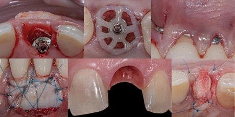 Hauptbild für Mucogingival Surgery around Teeth & Implants