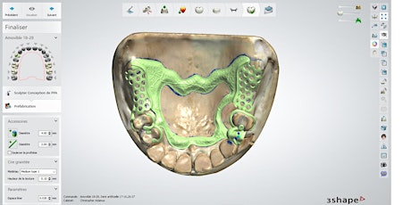 Webinaire 3Shape Dental System PEI et châssis
