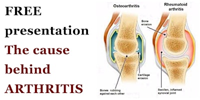 The cause behind ARTHRITIS primary image