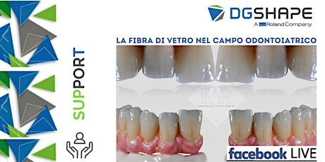 DGSHAPE:Fibra di vetro nel campo odontoiatrico_ Opportunità ed innovazione_Facebook LIVE 